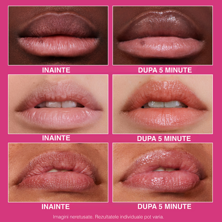Tratament pentru buze FirmX Lip Filler, 10 ml, Peter Thomas Roth 605898