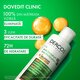 Sampon si balsam 2 in 1 antimatreata pentru scalp cu senzatie de mancarime Dercos, 200 ml, Vichy 748114