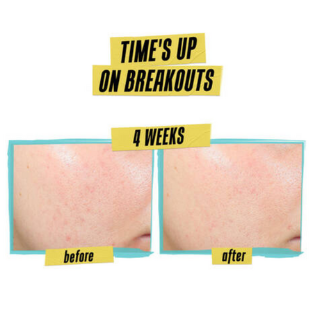 Crema anti-imperfectiuni Expertly Clear Blemish-Treating and Preventing, 60 ml, Kiehl's 622222