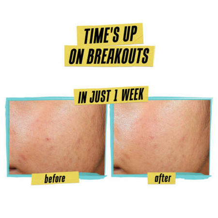 Crema anti-imperfectiuni Expertly Clear Blemish-Treating and Preventing, 60 ml, Kiehl's 622223