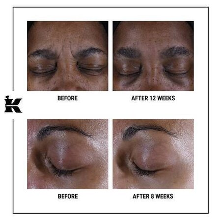 Crema multi-corectoare pentru zona ochilor Super Multi-Corrective, 14 ml, Kiehl's 622521