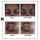 Crema multi-corectoare pentru zona ochilor Super Multi-Corrective, 14 ml, Kiehl's 622521