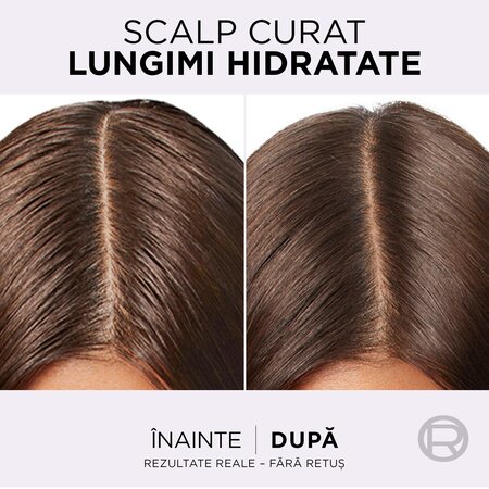 Pachet Sampon pentru scalp si radacini grase si lungimi deshidratate Hyaluron Pure, 250 ml + 250 ml, Elseve 623104