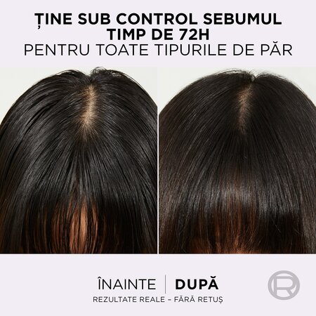 Pachet Sampon pentru scalp si radacini grase si lungimi deshidratate Hyaluron Pure, 250 ml + 250 ml, Elseve 623106