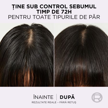 Sampon purificator pentru scalp gras Hyaluron Pure, 400 ml, Elseve 663695