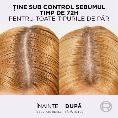 Sampon purificator pentru scalp gras Hyaluron Pure, 400 ml, Elseve 663697