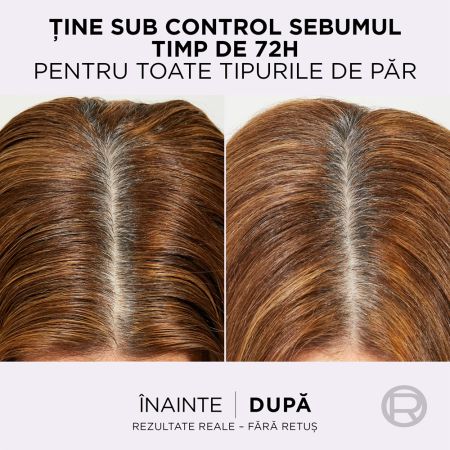 Sampon purificator pentru scalp gras Hyaluron Pure, 400 ml, Elseve 663696