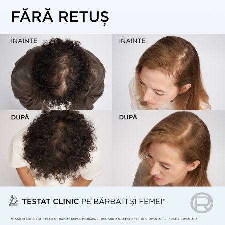 Balsam impotriva caderii parului Growth Booster, 150 ml, Elseve 663703