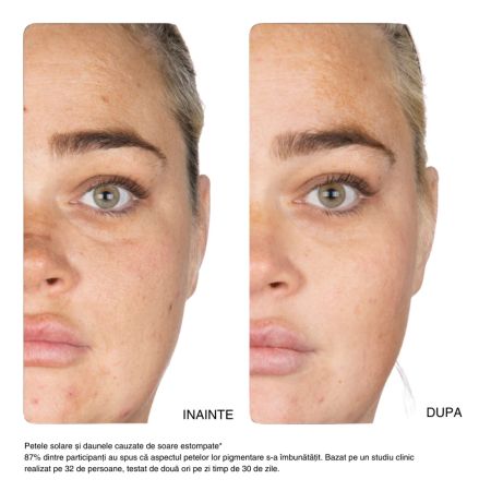 Serum concentrat pentru fata 15% Vitamin C, 30 ml, NIP+FAB 643748