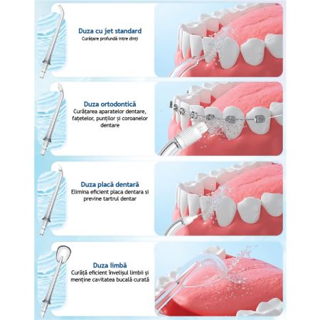 Set rezerve pentru dus bucal PM 42, 4 bucati, Perfect Medical 654095