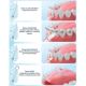 Set rezerve pentru dus bucal PM 42, 4 bucati, Perfect Medical 654095