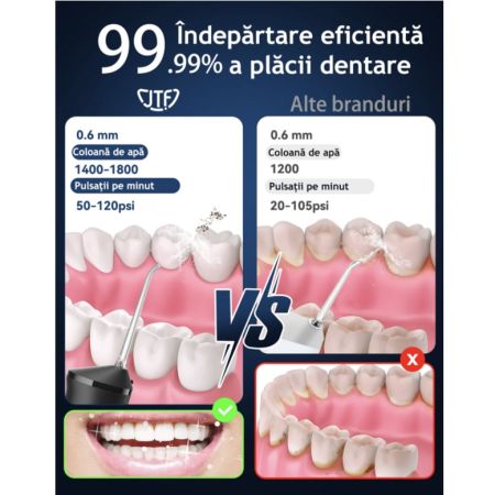 Irigator bucal cu lampa UV Negru F300, 1 bucata, JTF 654386