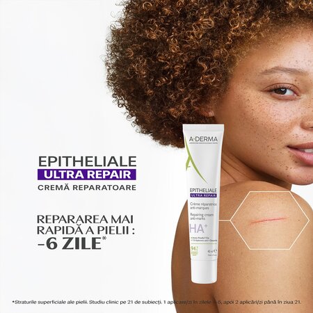 Crema reparatoare pentru pielea deteriorata Epitheliale Ultra Repair, 40 ml, A-Derma 661597