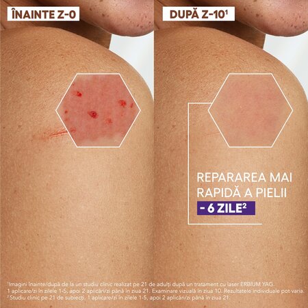 Crema reparatoare pentru pielea deteriorata Epitheliale Ultra Repair, 40 ml, A-Derma 661599