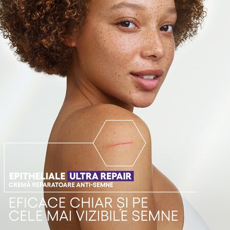 Crema reparatoare pentru pielea deteriorata Epitheliale Ultra Repair, 40 ml, A-Derma 661601