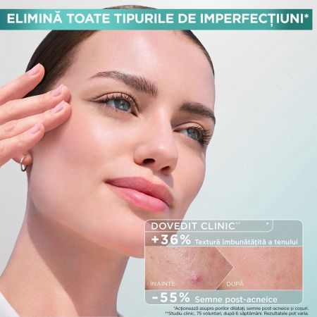 Lotiune tonica cu acid salicilic Pure Active, 120 ml, Garnier 663787