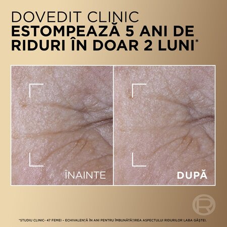 Serum antirid pentru fermitate si luminozitate Age Perfect Duo, 30 ml, L'Oreal Paris 663799