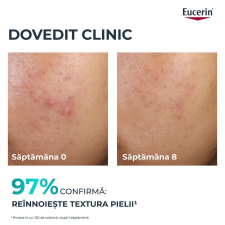 Tratament exfoliant cu acid salicilic pentru noapte Dermo Pure, 40 ml, Eucerin 665568