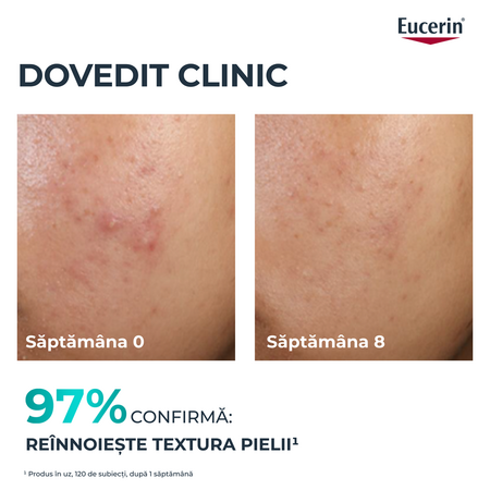 Tratament exfoliant cu acid salicilic pentru noapte Dermo Pure, 40 ml, Eucerin 665568