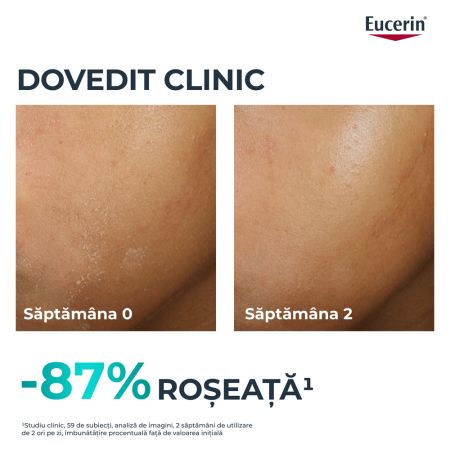 Fluid pentru fata hidratant Dermo Pure, 40 ml, Eucerin 665649