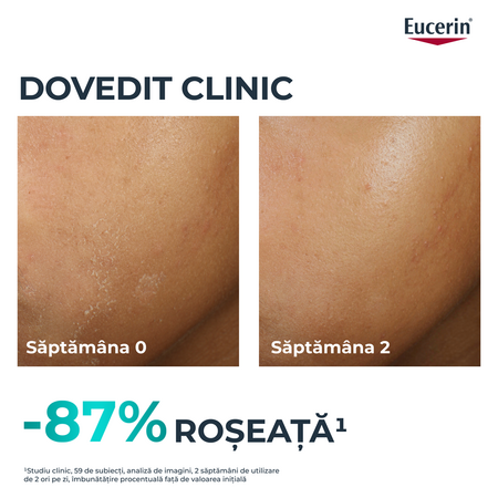 Fluid pentru fata hidratant Dermo Pure, 40 ml, Eucerin 665649