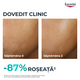 Fluid pentru fata hidratant Dermo Pure, 40 ml, Eucerin 665649