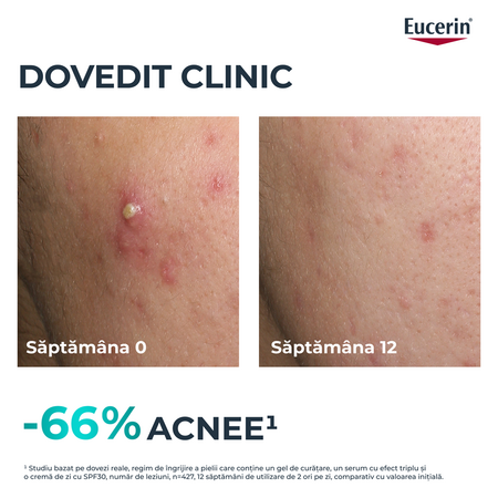 Ser cu tripla actiune Dermo Pure, 40 ml, Eucerin 665661