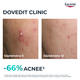 Ser cu tripla actiune Dermo Pure, 40 ml, Eucerin 665661