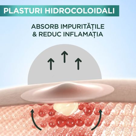 Plasturi invizibili pentru cosuri Pure Active, 8 bucati, Garnier 666071