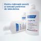 Sampon tratament anti-matreata severa si anti-mancarimi Kelual DS Intensive, 100 ml, Ducray 671912