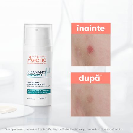 Concentrat anti-imperfectiuni pentru tenul acneic Cleanance Comedomed+, 30 ml, Avene 671982