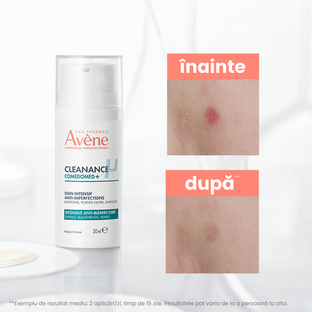 Concentrat anti-imperfectiuni pentru ten cu acnee Cleanance Comedomed+, 30 ml, Avene 671982