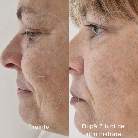 Sublime Peau Anti Age, 60 comprimate, Santarome 677674