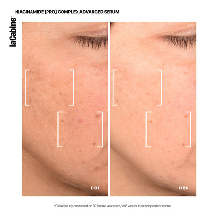 Ser de fata cu micro-sfere pentru corectarea petelor si luminozitate Niacinamide Pro Complex Multi-active, 30 ml, La Cabine 696320