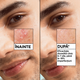 Serum anti-imperfectiuni cu acid salicilic Pure Active Salicylic, 30 ml, Garnier 697301