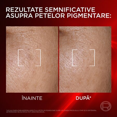 Serum-crema anti-imbatranire Revitalift Laser Triple Laser, 50 ml, LOreal 715706