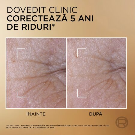 Serum 2 in 1 pentru fermitate Age Perfect Le Duo, 15 ml, LOreal 715720