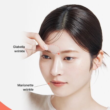 Plasturi cu microcone si retinol Reti-Rn T-Shape, 4 bucati, Acropass 716661