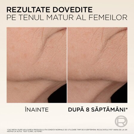 Serum pentru fermitate cu micro-peptide de colagen Age Perfect Collagen Expert, 30 ml, LOreal 716761