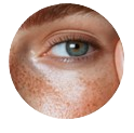 Reducerea ridurilor