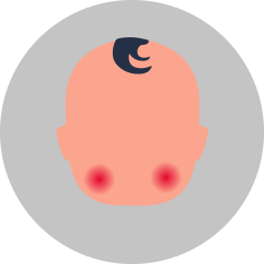 Febra