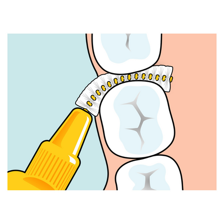 Periute interdentare Marimea 1 Portocaliu Original, 6 bucati, TePe 730378