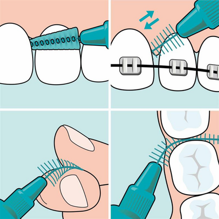 Periute interdentare S/M EasyFit, 6 bucati, TePe 730746