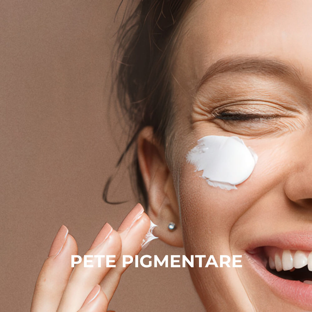 Sesderma &mdash; Pete pigmentare