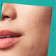 Plasturi hidrocoloidali pentru diminuarea imperfectiunilor Truly Targeted Overnight Blemish, 22 bucati, Kiehl's 738742