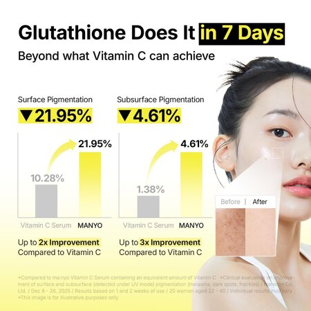 Ser intensiv pentru pete pigmentare Glutathione 7 Dark Spot Serum, 30 ml, Manyo 742147