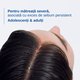 Sampon anti-matreata pentru scalp gras Kelual DS Sebocontrol, 100 ml, Ducray 742590
