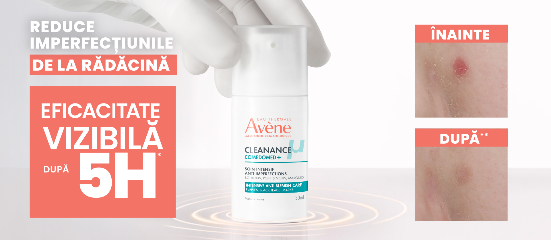 Cleanance Comedomed