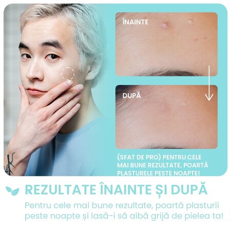 Plasturi pentru cosuri cu ulei de arbore de ceai Emergency Dots, Pimple Patches, 72 bucati, Breakout+Aid 750357