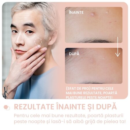 Plasturi pentru cosuri cu acid salicylic Emergency Dots, Pimple Patches, 72 bucati, Breakout+Aid 750384
